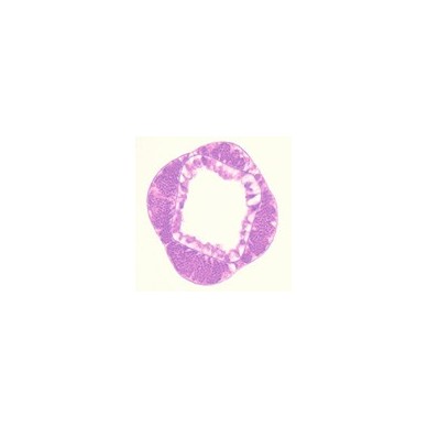 Ovario de hidra, s.t.
