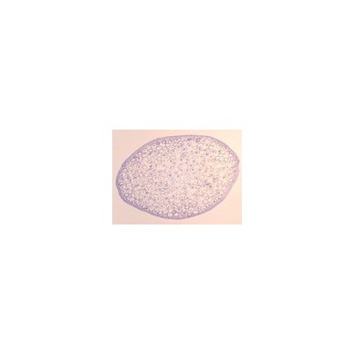 Mitosis en huevos de áscaris de caballo
