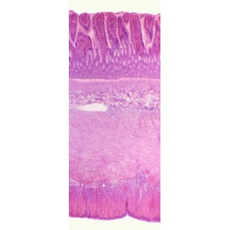 Intestino grueso, s.t.