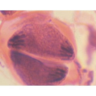 Meiosis, antera de lirio, s.t.