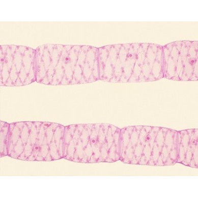 Masa vegetativa de Spirogyra, m.e.