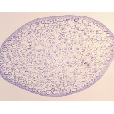 Mitosis en huevos de áscaris de caballo