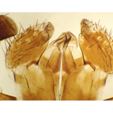 Aparato bucal de Periplaneta (cucaracha), m.e.