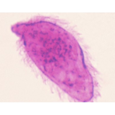 Miracidio de Schistosoma, m.e.