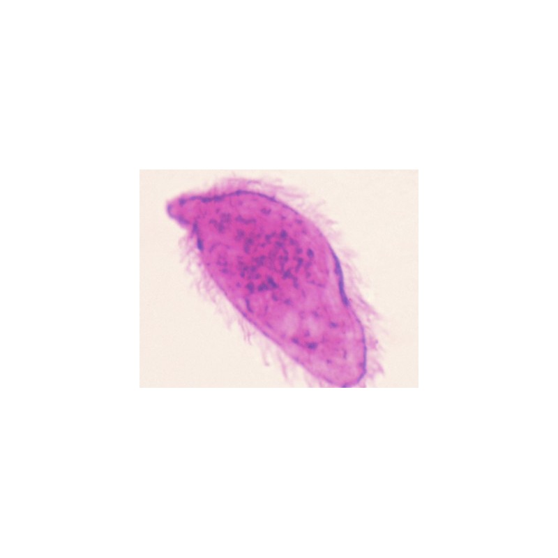 Miracidio de Schistosoma, m.e.