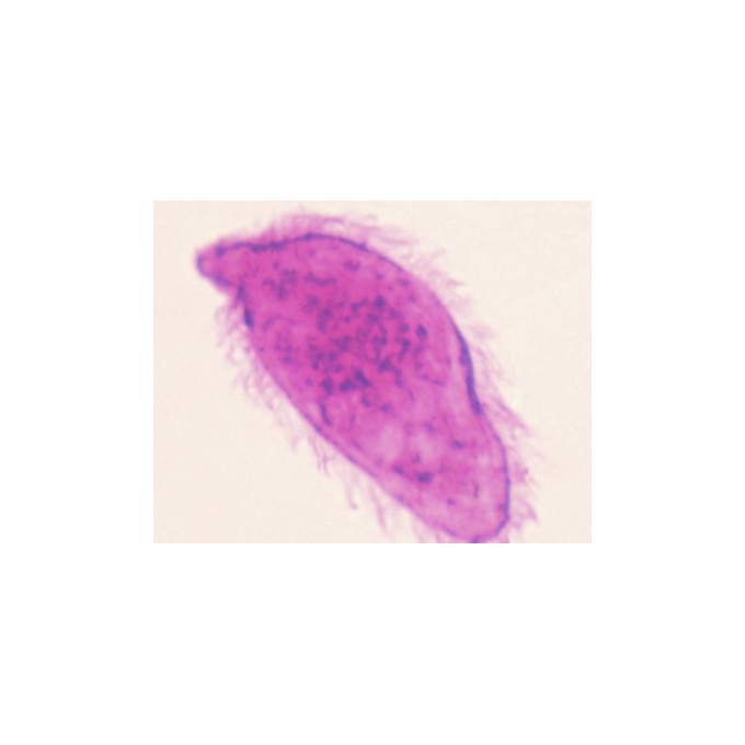 Miracidio de Schistosoma, m.e.