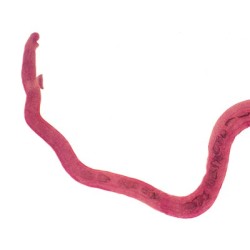 Hembra de Schistosoma, m.e.