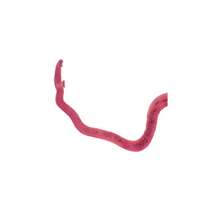 Hembra de Schistosoma, m.e.