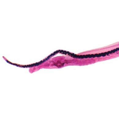 Conjugación de Schistosoma macho y hembra, m.e.