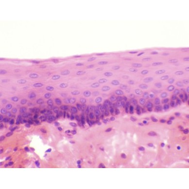 Epitelio estratificado plano, sec.