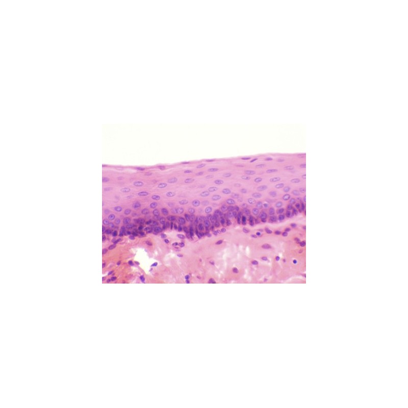 Epitelio estratificado plano, sec.