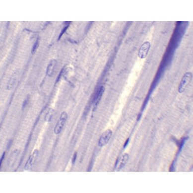 Músculo cardiaco, sec.