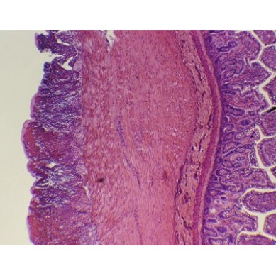 Intestino delgado, s.t.