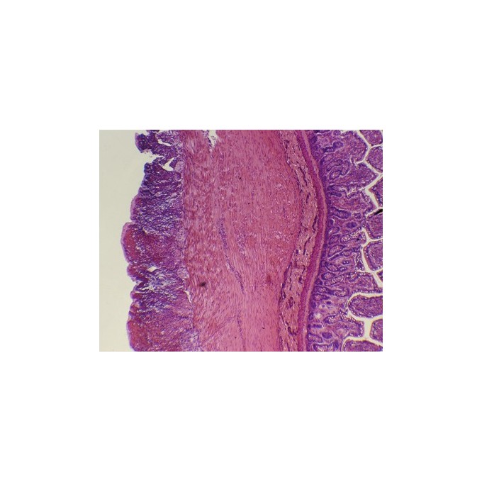 Intestino delgado, s.t.
