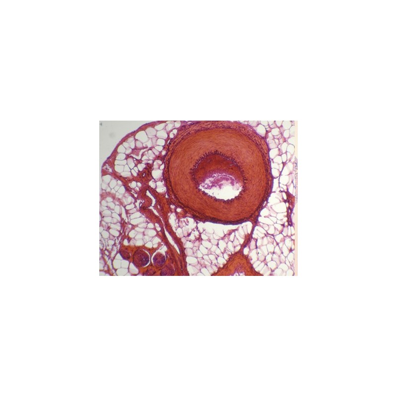 Arteria y vena, s.t.