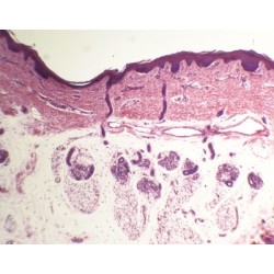 Piel humana, glándulas sudoríparas, sec.