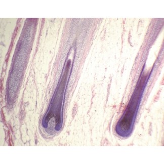 Piel humana, folículos pilosos, sec.