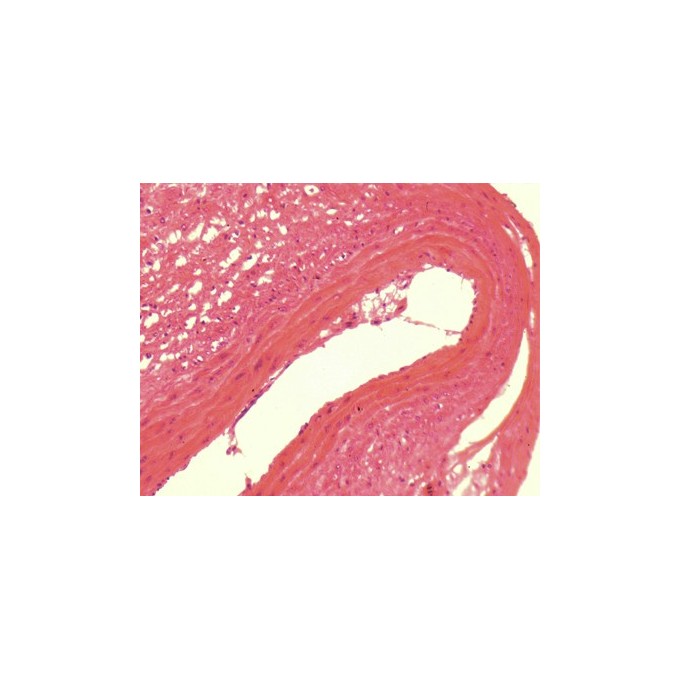 Arteria de rana, s.t.