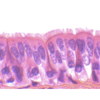 Epitelio ciliado, sec.