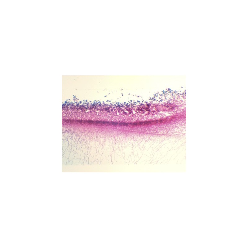 Penicillium, m.e.