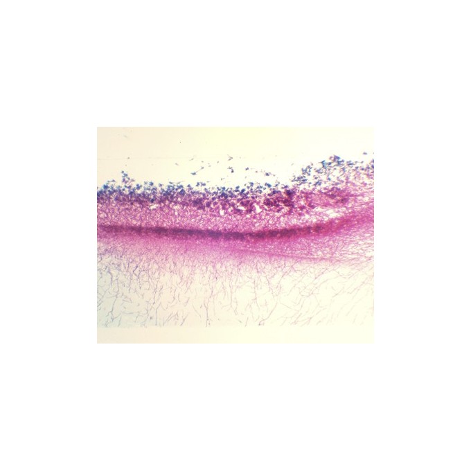 Penicillium, m.e.