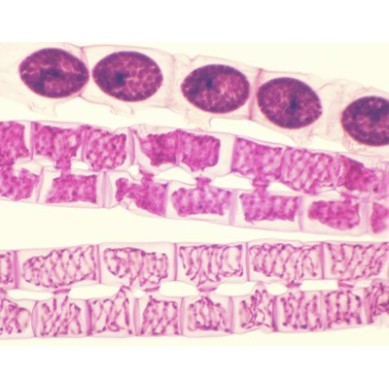 Conjugación de Spirogyra, m.e.