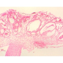 Anteridio de Marchantia, s.l.