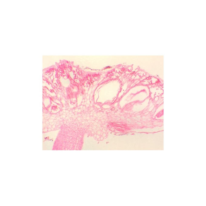 Anteridio de Marchantia, s.l.