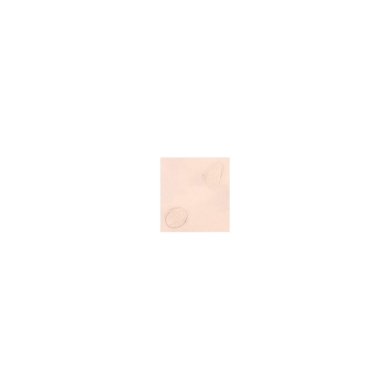 Huevos de Schistosoma, m.e.
