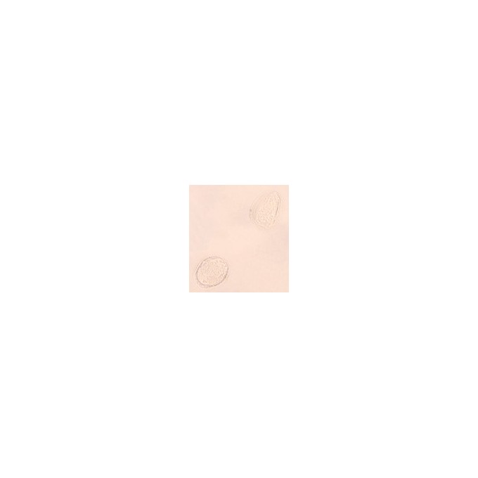 Huevos de Schistosoma, m.e.