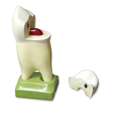 Premolar superior c··2 raíces