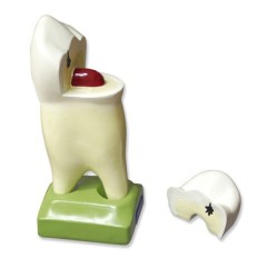 Premolar superior c··2 raíces