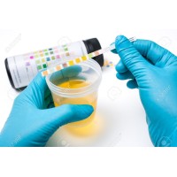 Tiras Analiticas
